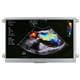 Newhaven Display NHD-7.0-HDMI-N-RSXP
